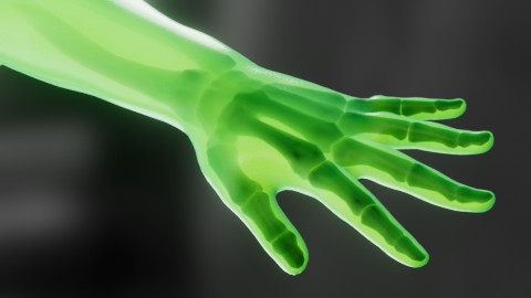 X-Ray Skeleton Arm